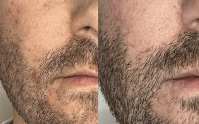 Men’s Skincare and Wellness: Why More Men Are Making Time for Self-Care